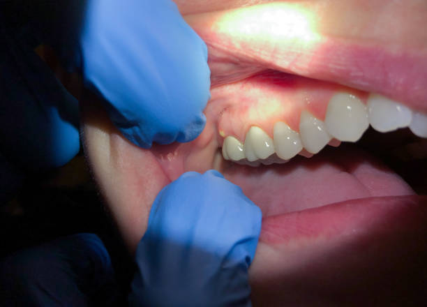 Best Emergency TMJ Treatment in Waxhaw, NC