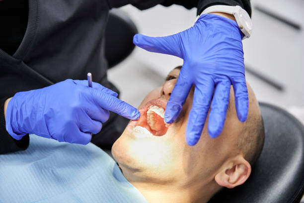 Best Urgent Care for Lost Fillings or Crowns in Waxhaw, NC