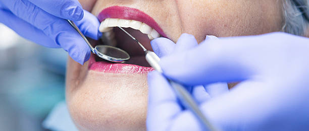 Best Emergency Dental Care for Broken or Chipped Teeth in Waxhaw, NC
